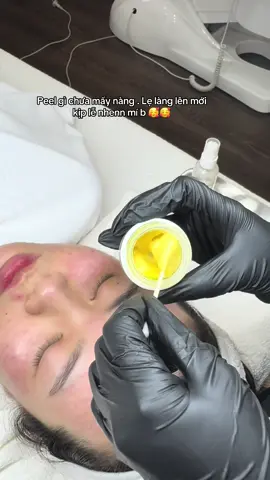 Thời điểm vàng để Peel da đón noenl #xhtiktok #YowonSpa #fypシ゚viral 