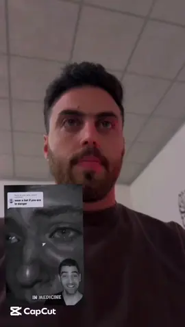 ديرررربالك واحذررر⛔️❌🚫 احفظ اسم هاي الابرة حتى لا تتورط وتاخذها بشكل غلط وتصير احمر ويهبط ضغطك وتتاذى #الصيدلاني_عبدالله_فتحي #دواء_خطير #فانكومايسين #صيدلاني #اعراض_جانبية 