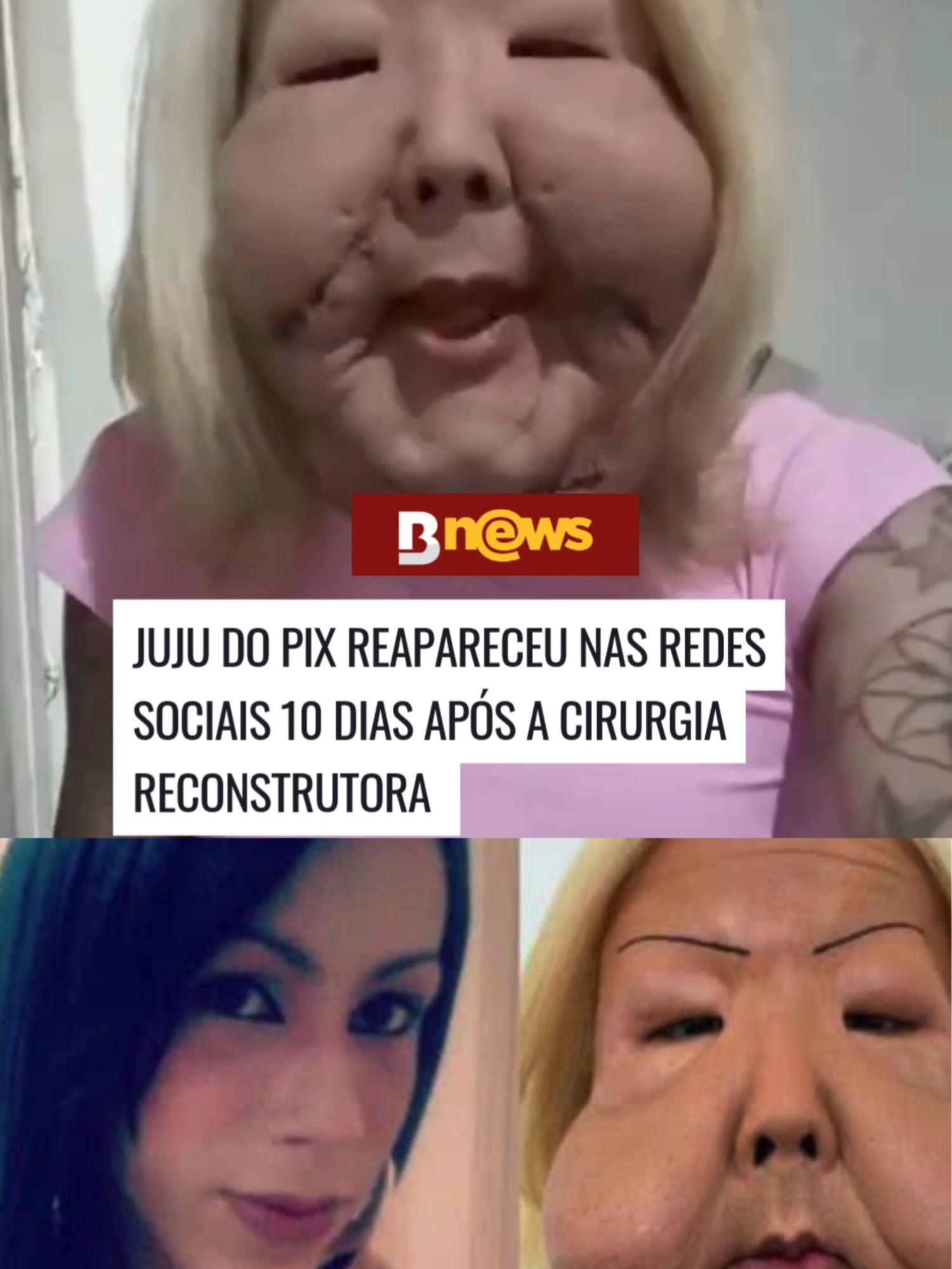 🩹A influenciadora, ainda em recuperação, agradeceu à equipe médica responsável pelo procedimento e ao carinho que vem recebendo de seus seguidores. Ela também afirmou estar confiante nessa nova fase. Nos comentários, seguidores celebraram sua evolução e desejaram força para a continuidade do processo de restabelecimento.  #JujuDoPix #Recuperação #Força #NovaFase #ApoioDosFãs