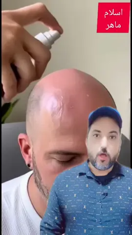 تكثيف وتطويل الشعر  #pressedpowder  #aspendrop  #lipgloss     #lipgloss #makeup                          