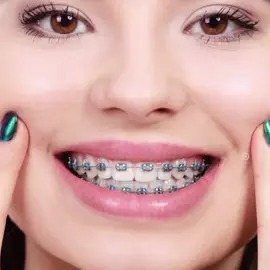 بەس ئازارەکەی ناخوشە😁😂🙂 #viralvideo .#forpagyoy #fyppp 