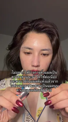 มันคือยาสามัญที่ควรมีติดบ้านจริงๆ#provamed #โปรวาเมด #ยาทาแผลเป็น #คีลอยด์ #รีวิวของดีบอกต่อ 