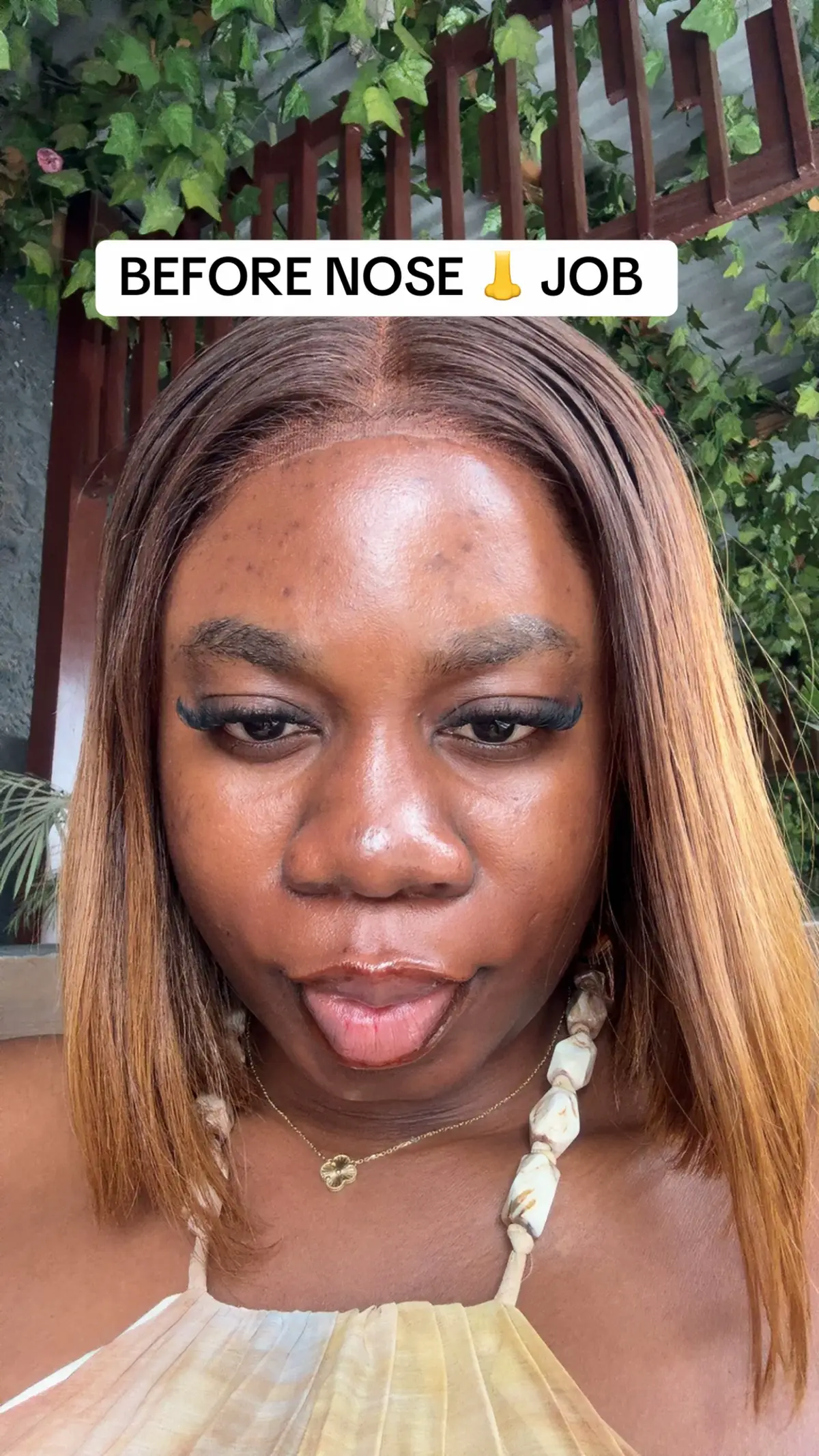 3 weeks in , best decision ever ,  swelling part is annoying but I will do this over and over again 