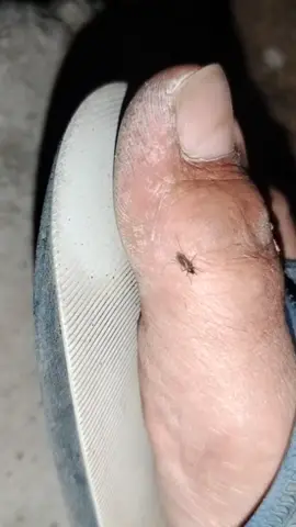 🦟🏠🤣#mosquitos