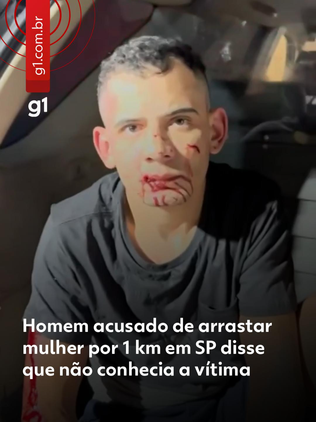 Vítima teve pernas amputadas - Preso no último domingo (30), acusado de atropelar e arrastar uma jovem na Marginal do Tietê, Douglas Alves da Silva, de 26 anos, chegou a dizer à polícia que não conhecia Tainara Souza Santos. Tainara teve as pernas amputadas após ser arrastada por cerca de 1 km e está internada em estado grave e intubada no Hospital das Clínicas, Zona Oeste de São Paulo. No ato da prisão, Douglas Alves tentou reagir e tomar a arma de um policial e foi baleado. Já na viatura para ser levado à delegacia, o agressor de Tainara disse que a intenção dele era atropelar um acompanhante da mulher que supostamente o tinha ameaçado de morte. “Não conheço ela, meu rei. Tudo mentira na internet, senhor. A verdade é que teve uma confusão lá dentro, com um cara que tava com ela. Quando ele saiu, falou que ia me matar. Eu voltei e fui para atropelar ele. Não vi ela, não conhecia ela não”, disse. De acordo com familiares e amigos, Tainara e o agressor mantiveram um relacionamento curto e esporádico. Segundo a Polícia Civil e relatos de testemunhas, o crime ocorreu por volta das 6h do sábado (29), depois que Tainara deixou um bar no Parque Novo Mundo, na Zona Norte de São Paulo. Veja os detalhes do caso no #g1clicando em 'leia o artigo'. #mulher #sãopaulo #g1local