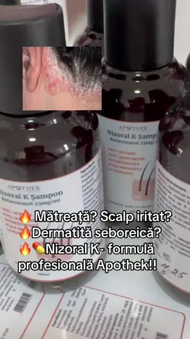 🔥Mătreață persistentă? Dermatită seboreică? Scalp iritat, cu mâncărime? Nizoral K Apothek este formula profesională cu ketoconazol 23mg/g, acid salicilic și acid lactic — acțiune combinată pentru un scalp curat, echilibrat și fără descuamare. Exfoliază delicat, calmează iritațiile și reduce scuamele încă din primele utilizări. Potrivit pentru mătreață severă, scalp sensibil, zone roșii și recidive frecvente. Aplicare ușoară, spumare controlată, efect rapid.  Detalii complete + mod de utilizare → în link-ul din bio, pe pagina Apothek. #matreata #dermatitaseboreica #ingrijirepar #haircareroutine #nizoralk 