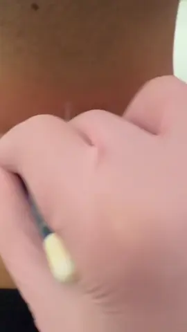 الرد على @الاكتفاء بلنفس راحه 💜 هل اكدر احدد رقبتي بالليزر ؟ #داود_الماهر 