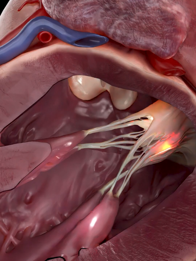 Left Ventricular View | Mitral & Aortic Valves in Motion  💓 - - - - Experience a rare internal look inside the left ventricle as the mitral and aortic valves work in perfect coordination. This close-up view reveals how the valve leaflets, chordae tendineae, and ventricular walls synchronize with every heartbeat to maintain forward blood flow and generate the strongest pressure in the human body. A clear demonstration of the precision and power that keep the heart pumping efficiently with every cycle. 💓. . . #LIVEFEST2025 #anatomy  #education  #cardiology  #smartdoctor1 
