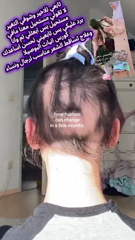 #كورس انبات البوصيلا وعلاج تساقط الشعر #رهف #ستايل #ترويج #طبيعة ،،