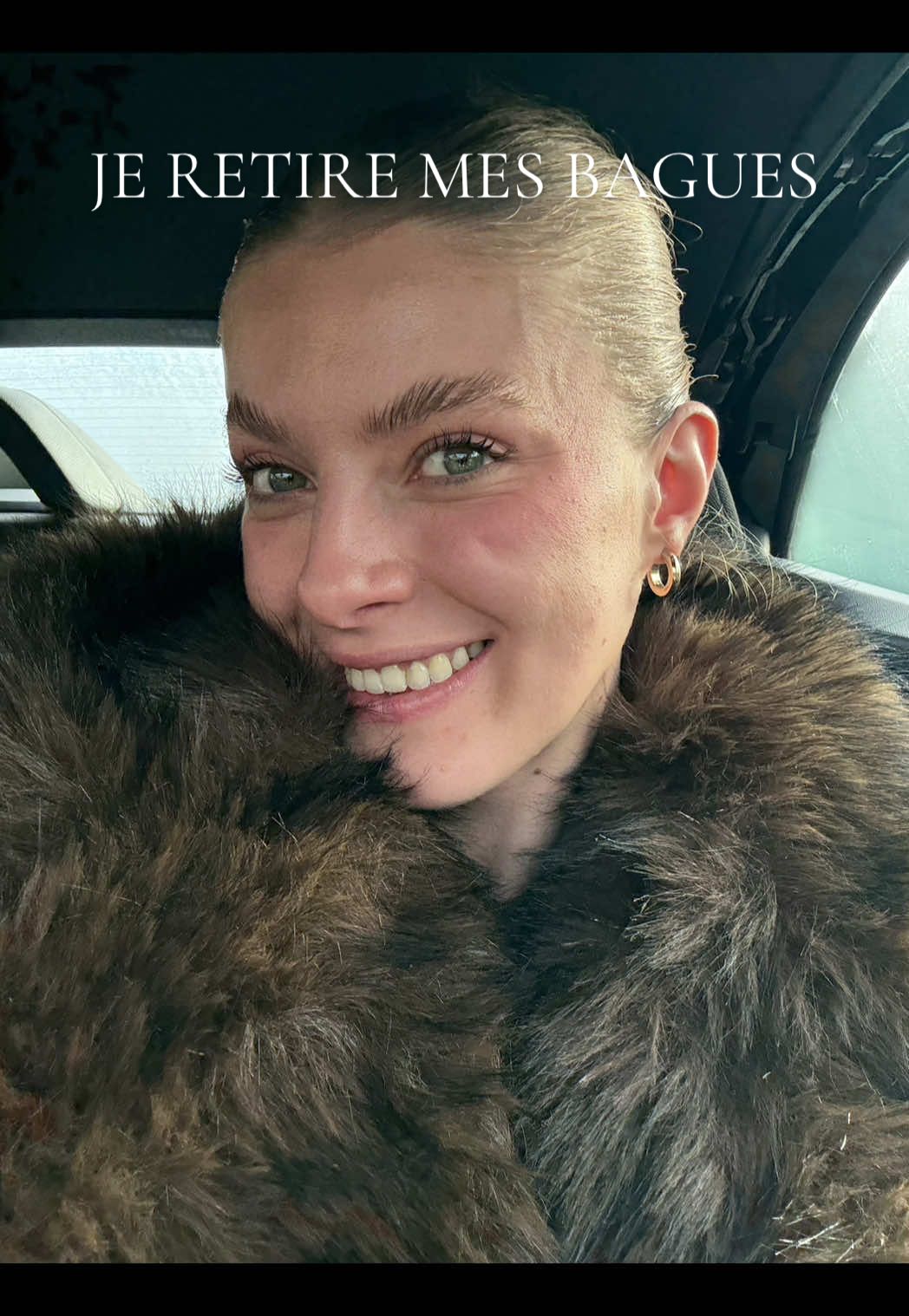 J’ai eu l’appareil dentaire, une opération de la mâchoire… et bientôt les implants dentaires. Presque 8 000€ de ma poche pour retrouver un sourire normal. Et le pire ? Si mes parents avaient suivi mon évolution plus jeune, je n’aurais jamais eu à gérer tout ça… Mais aujourd’hui, je suis fière d’avoir trouvé la force et les moyens d’y arriver toute seule. 🫶✨ #appareildentaire #dents #evolution #sourire #beauty 