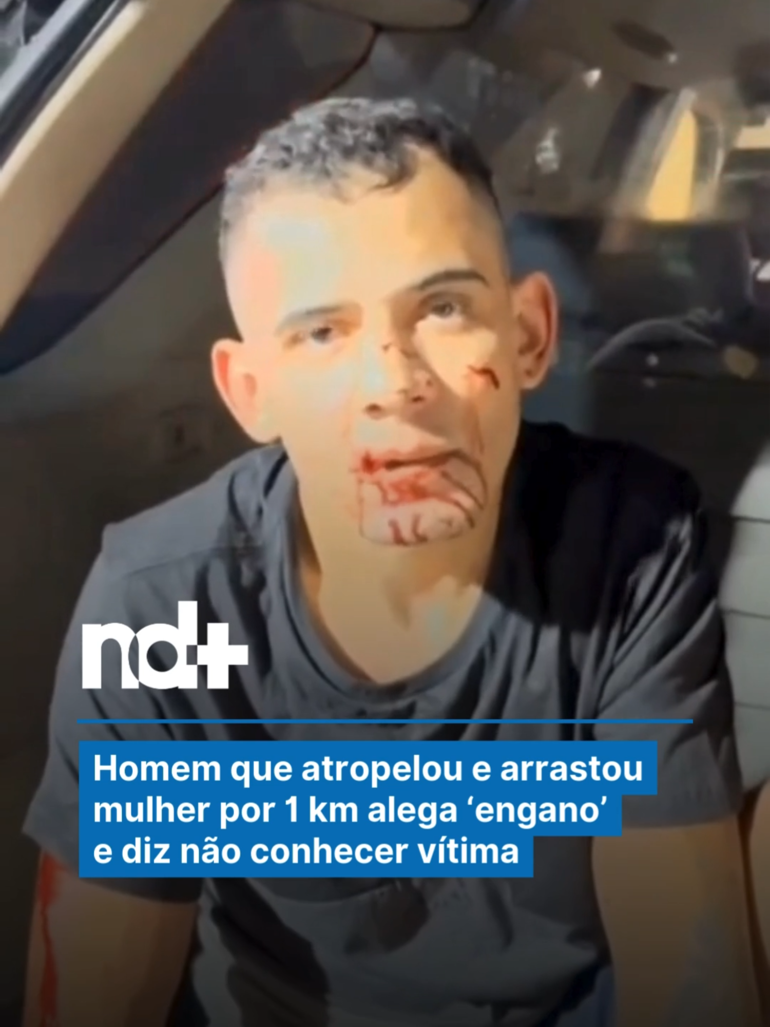 O homem que atropelou e arrastou uma mulher na Marginal do Tietê, em São Paulo, alegou que o atropelamento teria ocorrido por engano. Douglas Alves da Silva, de 26 anos, segue sob investigação após sua prisão no último domingo (30). Segundo a Polícia Civil, ele é apontado como o responsável por atropelar e arrastar Tainara Souza Santos, 24 anos, por aproximadamente 1 km, resultando em graves ferimentos e amputação das pernas. Nos depoimentos iniciais, Douglas declarou que não conhecia Tainara e alegou que a intenção seria atingir um homem que teria o ameaçado momentos antes. Ele afirmou aos policiais que não percebeu a presença da jovem e que ela não teria relação com a briga. Testemunhas apresentaram outra versão, relatando que Douglas teria agido por ciúmes ao ver Tainara conversando com outro homem no bar onde ela estava. A partir desses relatos, a investigação passou a tratar o episódio como possível tentativa de feminicídio. Leia em #NDmais.  🎥 Gordo Fofoqueiro/gordofofoqueiro/X #NDmais#segurança#sp#polícia#crime#notícia