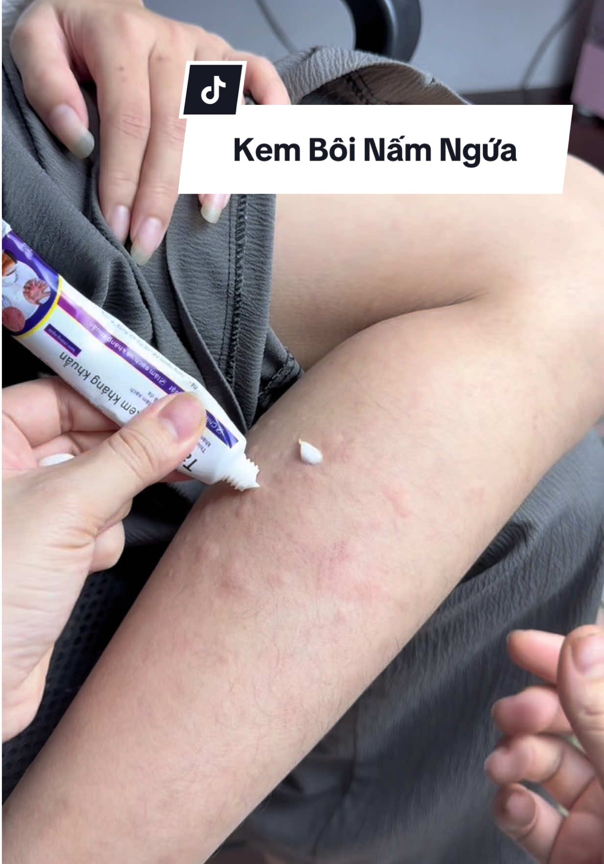 Viêm ngứa ngoài da thì dùng ngay kem kháng khuẩn này nhé #hagiangreview1#thinhhanh#xuhuong#kemboinamngua #kemkhangkhuantaikang  @Hà Giang Review1  @Hà Giang Review1  @Hà Giang Review1 
