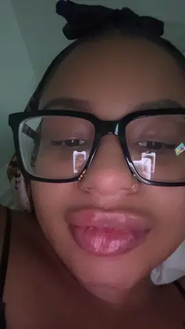 I love itttt #fyo #lips #filler #medspa 