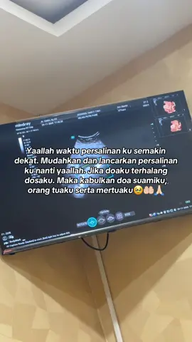 Masyaallah Tabarakallah cuma minta sehat2kan diriku dan lancarkan semuanya🥹 rasa dag-dig-dug ini semakin besar yaallah 🤲🏻 #fyp #bumilhappy #bumil #persalinannormal #36weekspregnant 