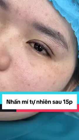 Tạo hình mí sau 15p #nhanmi #nhấnmí #nhanmitunhien #ilovetiktok #catmi 