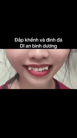 Đắp khểnh , đính đá cho bé khách biết em qua tiktok cám ơn bé đẹp đqx tin tưởng ủng hộ . Kg thích thì lướt quá nhoa mấy bà 🥰🥰