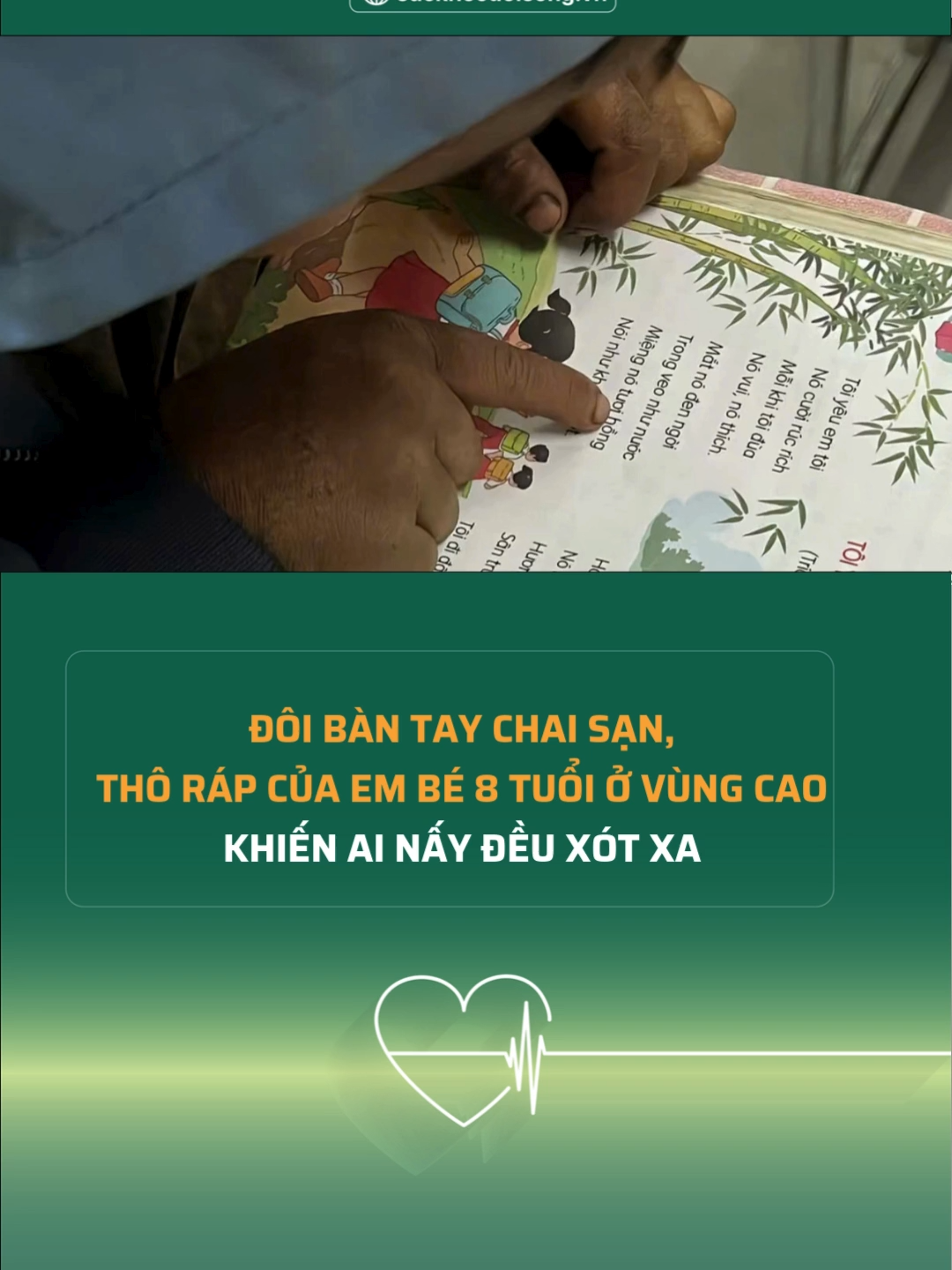 Đôi bàn tay chai sạn, thô ráp của em bé 8 tuổi ở vùng cao khiến ai nấy đều xót xa #suckhoedoisong #tintuc #tiktok #thuong