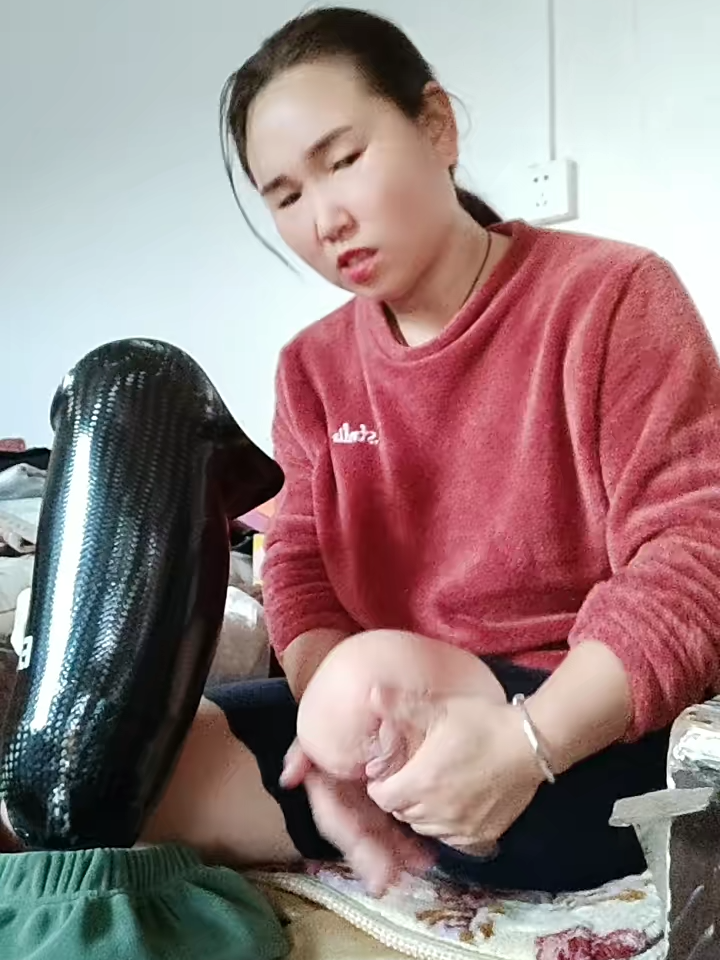 单腿🌵️王二妮儿🌸 一位三十多岁的女性在车祸中失去了一条腿，现在佩戴着假肢。加油！ 用积极乐观的心态迎接每一天，并记录你的生活。如果她害怕戴着新假肢走路，那么她应该如何适应新的关节呢？截肢腿的幻肢痛非常难受。#disabledtiktok #disabledvideos #disabled #disabledgirl❤ #disabilitytiktok #disability #amputeelife #amputeetiktok #amputeegirl #amputee #oneleggedgirl #onelegged #viralvideo #viraltiktok #viral #discover #prostheticleg #phantompain