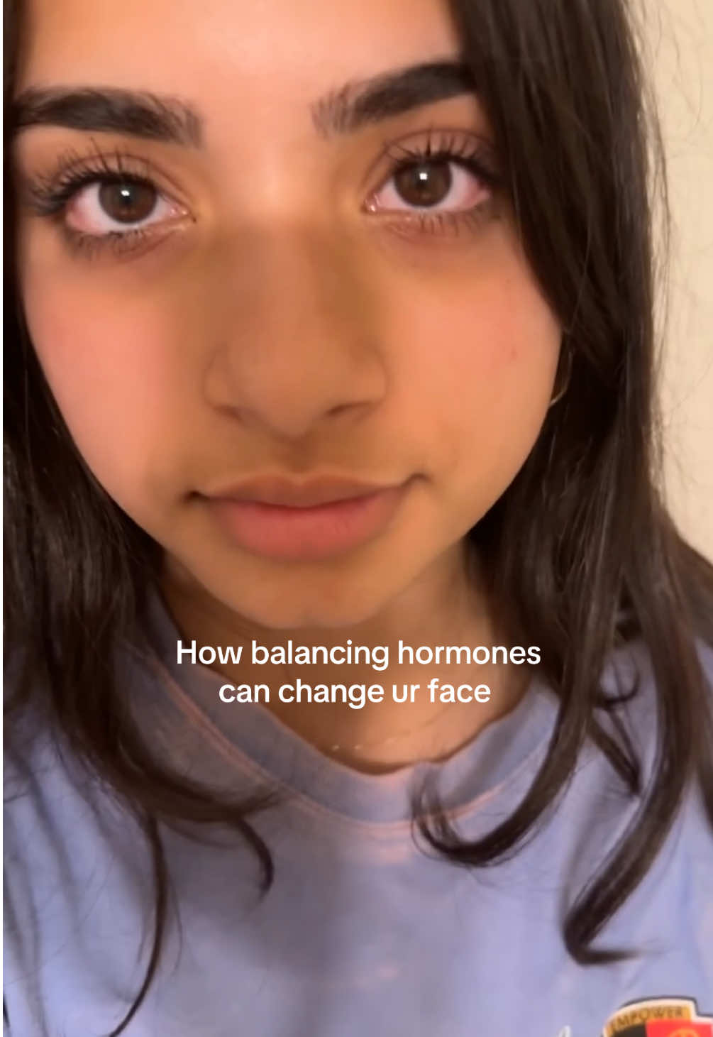 Cortisol face is real. The body keeps score 🤍