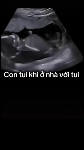 Muốn thấy con đạp đâu có dễ đâu ba #mẹbầu #binhngo #xuhuong 