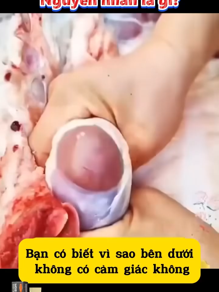 đã có 1.280.000 người sử dụng và cho đánh giá 5 sao trên toàn quốc . Đây là sản phẩm được các chuyên gia hàng đầu khuyên dùng.