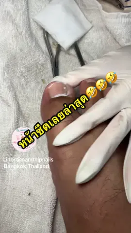 💓 #namthipnails #ตัดเล็บขบ #ตัดหนัง #ทำเล็บ #ร้านตัดเล็บขบ      Fb : namthipnails  Line : @namthipnails
