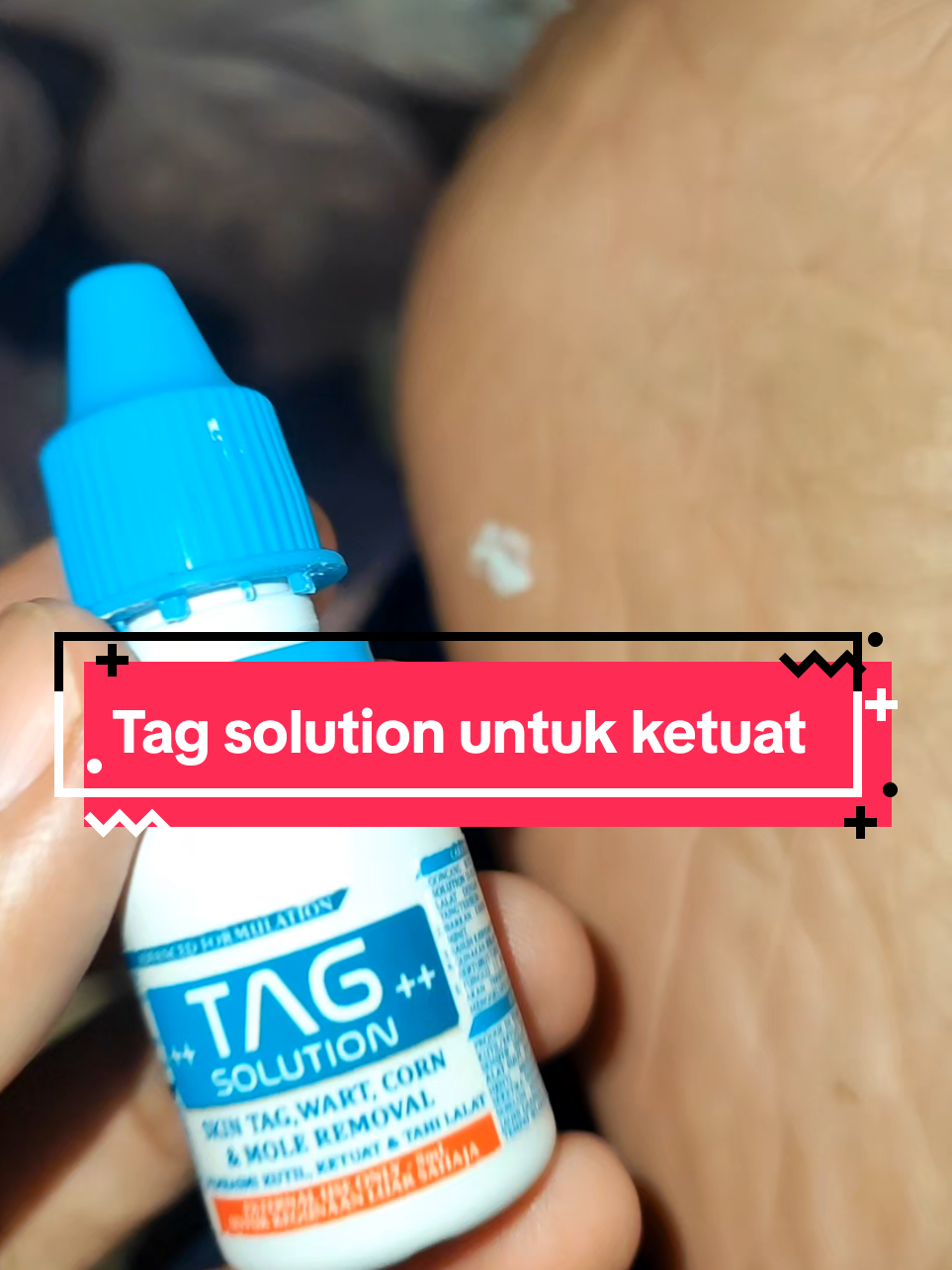 Replying to @tahlahh15 #tagsolution #tahilalat #kutil #ketuat 