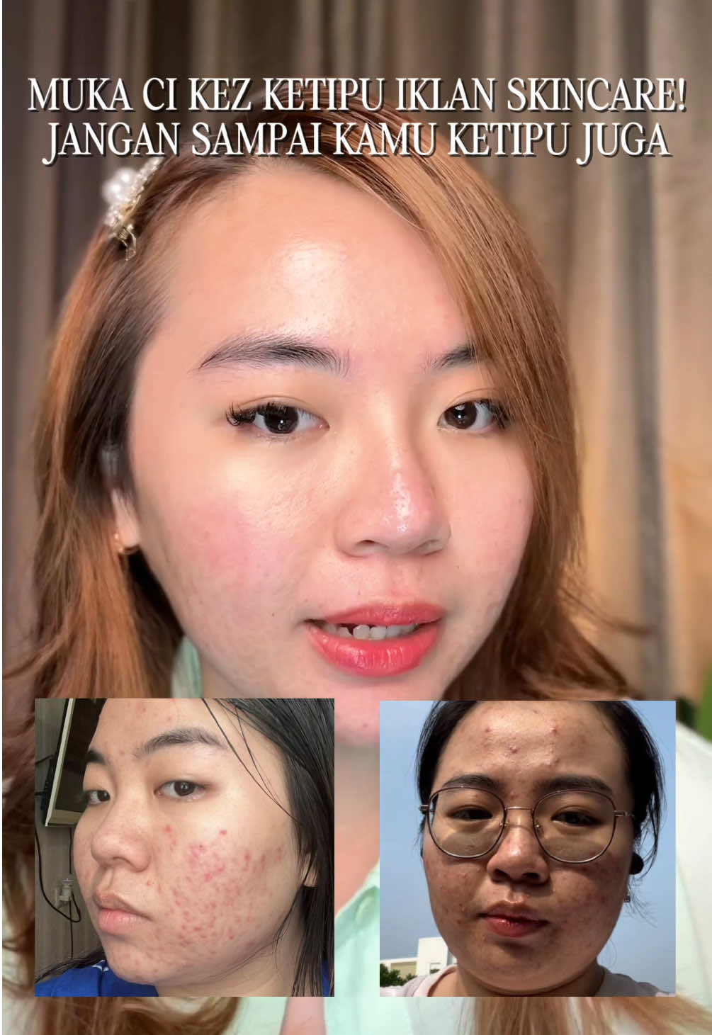 Ketipu iklan skincare malah jadi breakout parah? Jangan sampai kamu ngalamin hal yang sama kayak ci Kez ya.  Salah satu skincare yang beneran works di ci Kez dan beneran mendinginkan. Dazzle Me 2% BHA-Centella Capsule Acne Moisturizer, semua kandungannya dibutuhkan acne prone skin.  Buat oily dan acne prone skin, rugi kalau nggak cobain.  #moistviral  #skincareviral #dazzlememoisturizer #acneproneskin #katanyakezia 