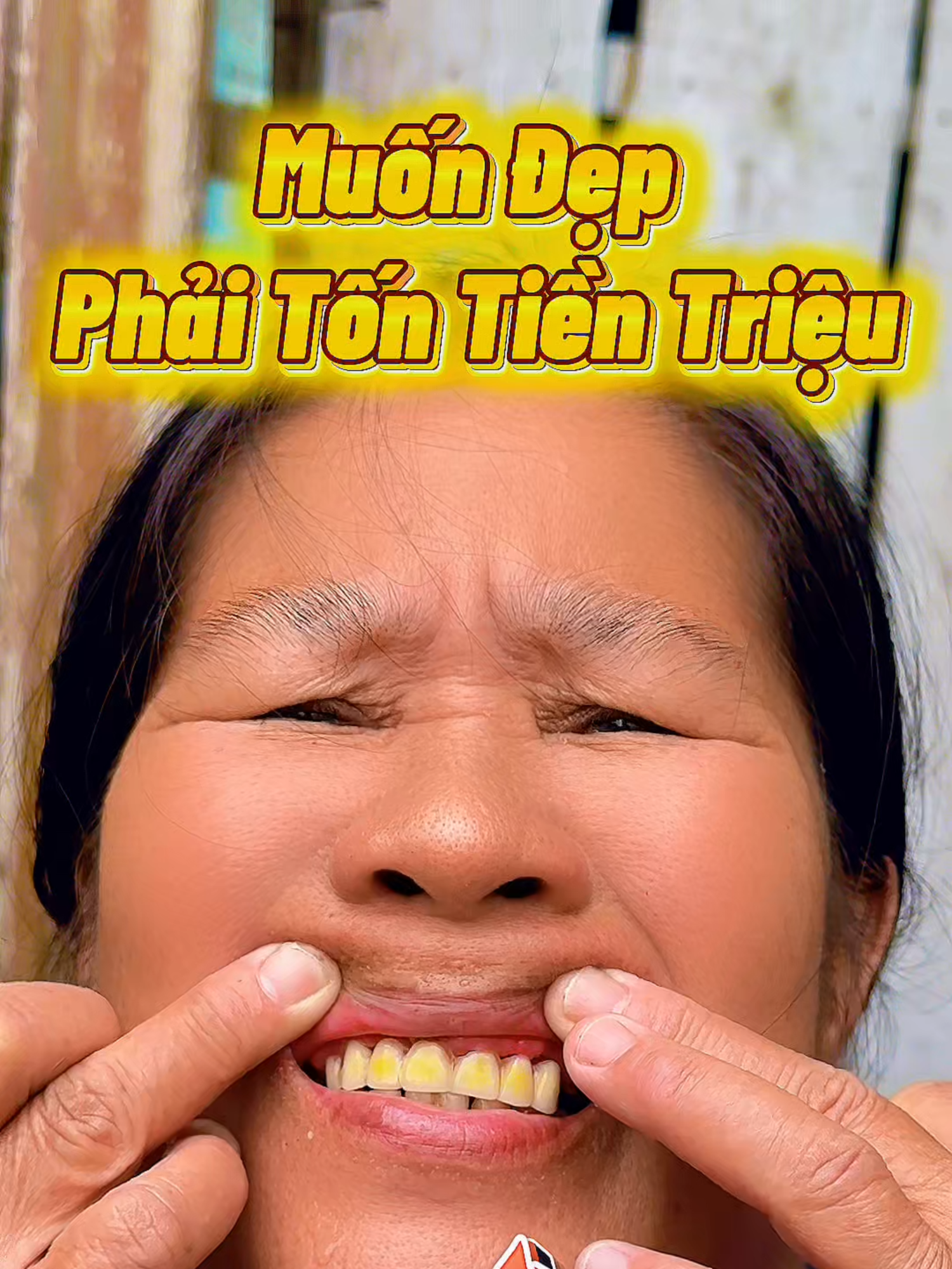 Phần 287 | Muốn đẹp thì phải bỏ tiền trăm hay tiền triệu??? #mqskin #trangrang #saptrangrang #lamtrangrang #kemdanhrang