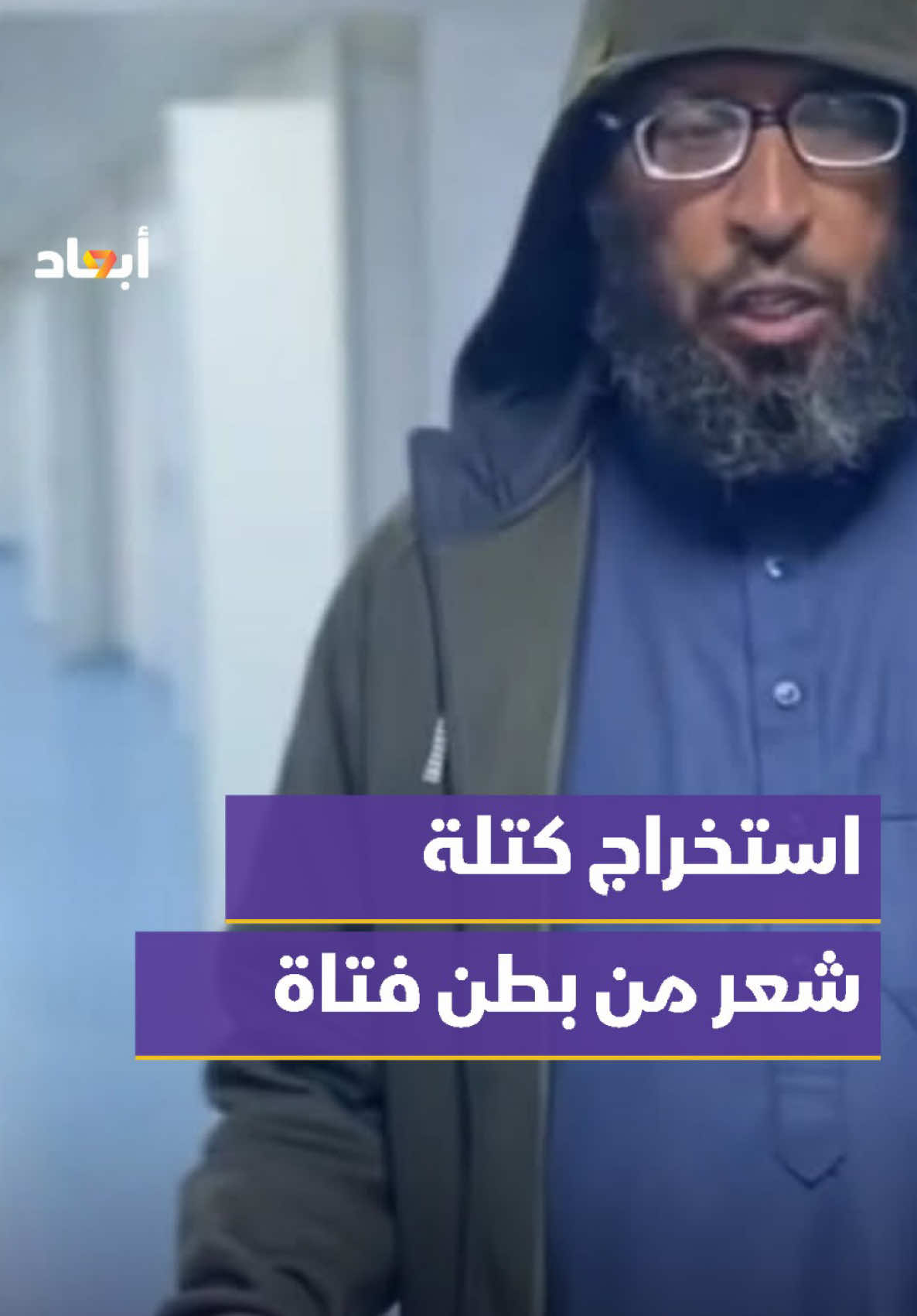 لجنة الحصين والبحث الجنائي توضح  حالة فتاة تبلغ من العمر 15 عاما خضعت لعملية جراحية أزيلت خلالها كتلة من الشعر من معدتها بعد تداول مزاعم بأنها ناتجة عن ممارسة السحر