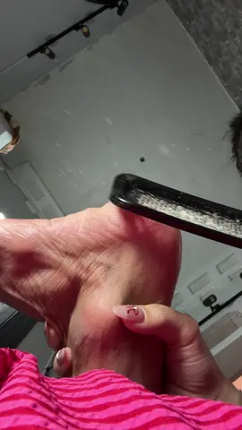 Chăm sóc da chân sau nó đã lắm mấy c #caychagotchan #chagotchan 