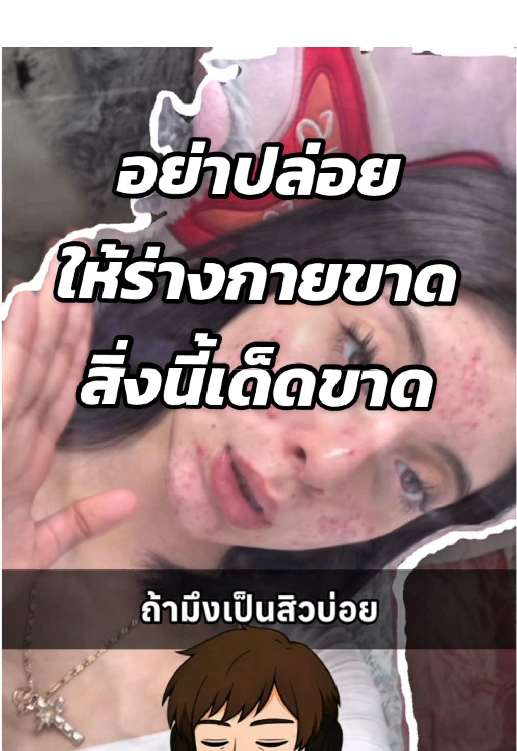 อย่าปล่อยให้ร่างกายขาดสิ่งนี้เด็ดขาด🤔 #สาระความรู้ #เมดิต้าซิงค์พลัส #ซิงค์ลดสิว #เมดิต้าซิงค์ #สิวลดลง 