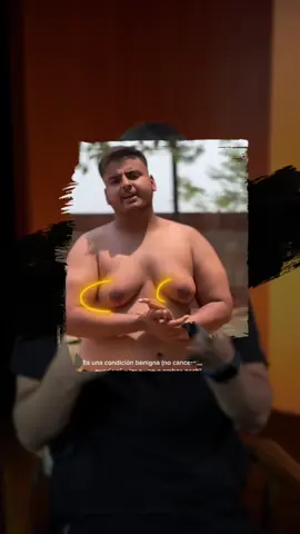 چارەسەری کێشەی گاینیکۆماستیا  سوپاس بۆ دکتۆر صابر مەمەندی  #doctor_hazhar #هەژارودروستی 