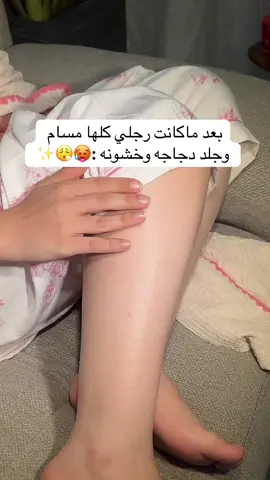 اخييرا عالجته🥺✨#اكسبلورexplore #الشعب_الصيني_ماله_حل😂😂 #explore #مالي_خلق_احط_هاشتاقات #جلد_الدجاجة 