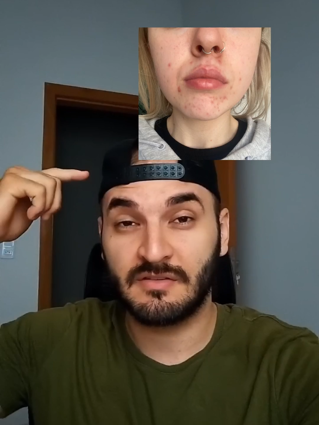 #saude #nac #fit #acne #inchaco