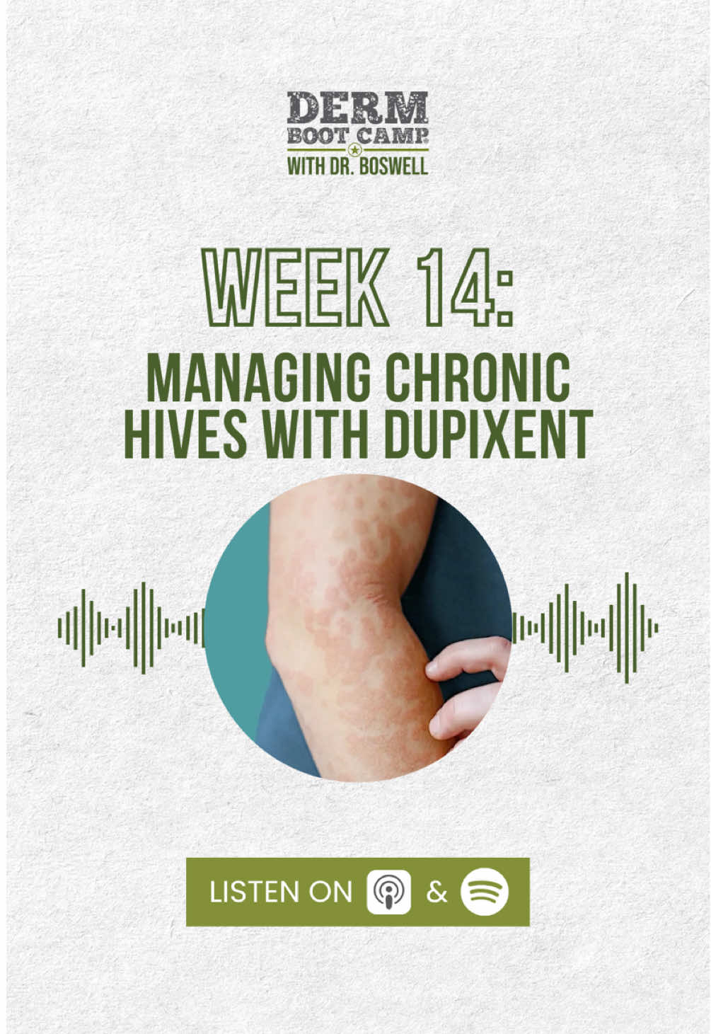 Episode 14 is here! 🎙️ ⚠️DISCLAIMER: Educational purposes only. NOT medical advice. — #Urticaria #ChronicHives #DermPodcast #DermTips #PhysicianAssistant   