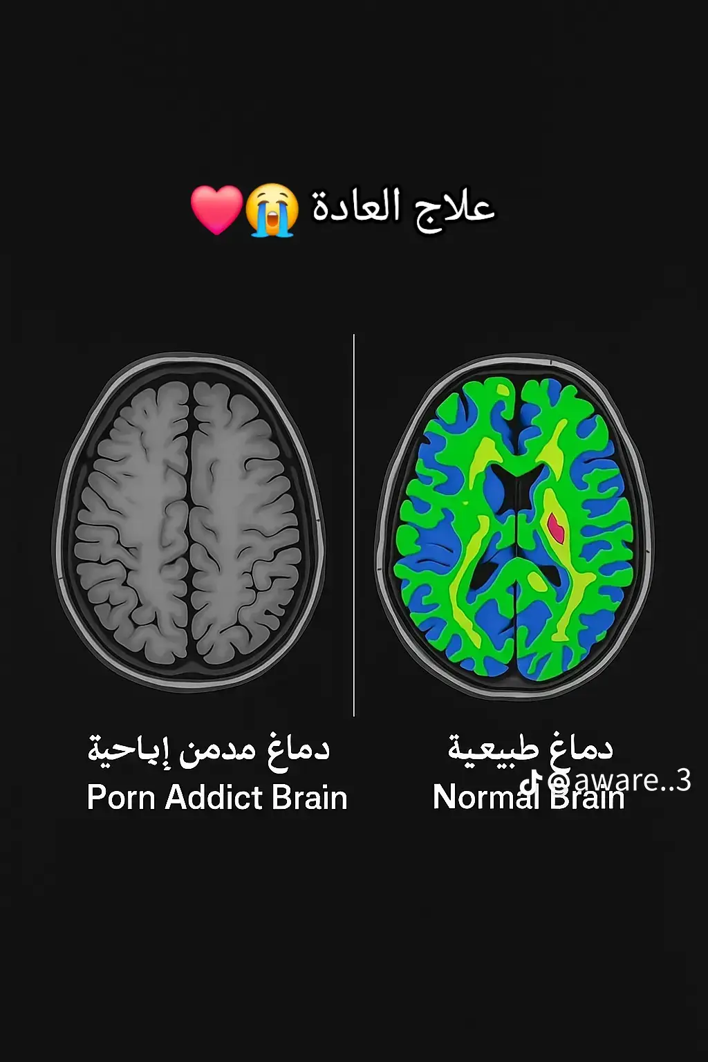 جبت لك الحل اللي هينقذك من إدمان الإباحية، وجبت لك الطريق اللي هيرجع لك حياتك.