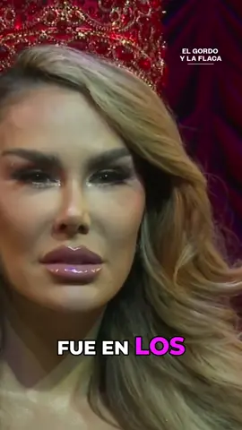 💰✨ ¡Sus ojos valen oro! Ninel da de qué hablar 😱 #ElGordoyLaFlaca, de lunes a viernes 4P/3C por Univision #NinelConde #BellezaQuePaga #Cirugía #clippeo