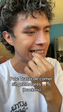 Comer sin premolares 🦷🔩 Brackets 👀🦷#brackets #dentista #bracketsmetalicos #ortodoncia  #creatorsearchinsights 