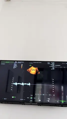 Âm thanh yêu nhất lúc này ạ ❤️   Em bé 6w1d❤️❤️❤️🤰