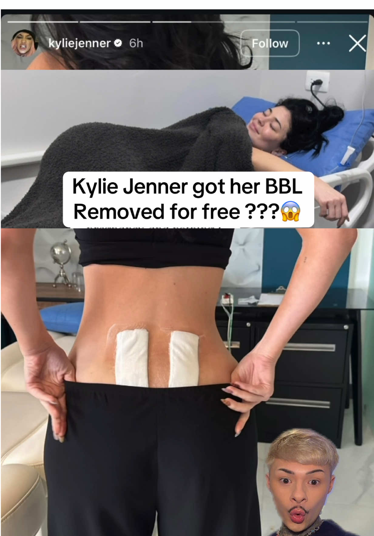 Kylie BBL era is over time to book your flights!?😭 #kyliejenner #drakhan #madonna #timotheechalamet #lourdesleon allegedly 