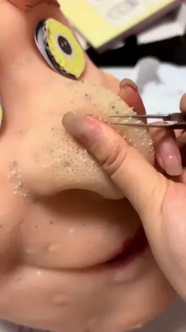 #oddlysatisfyingvideo #pimplepopping #asmr #fyp #relax 