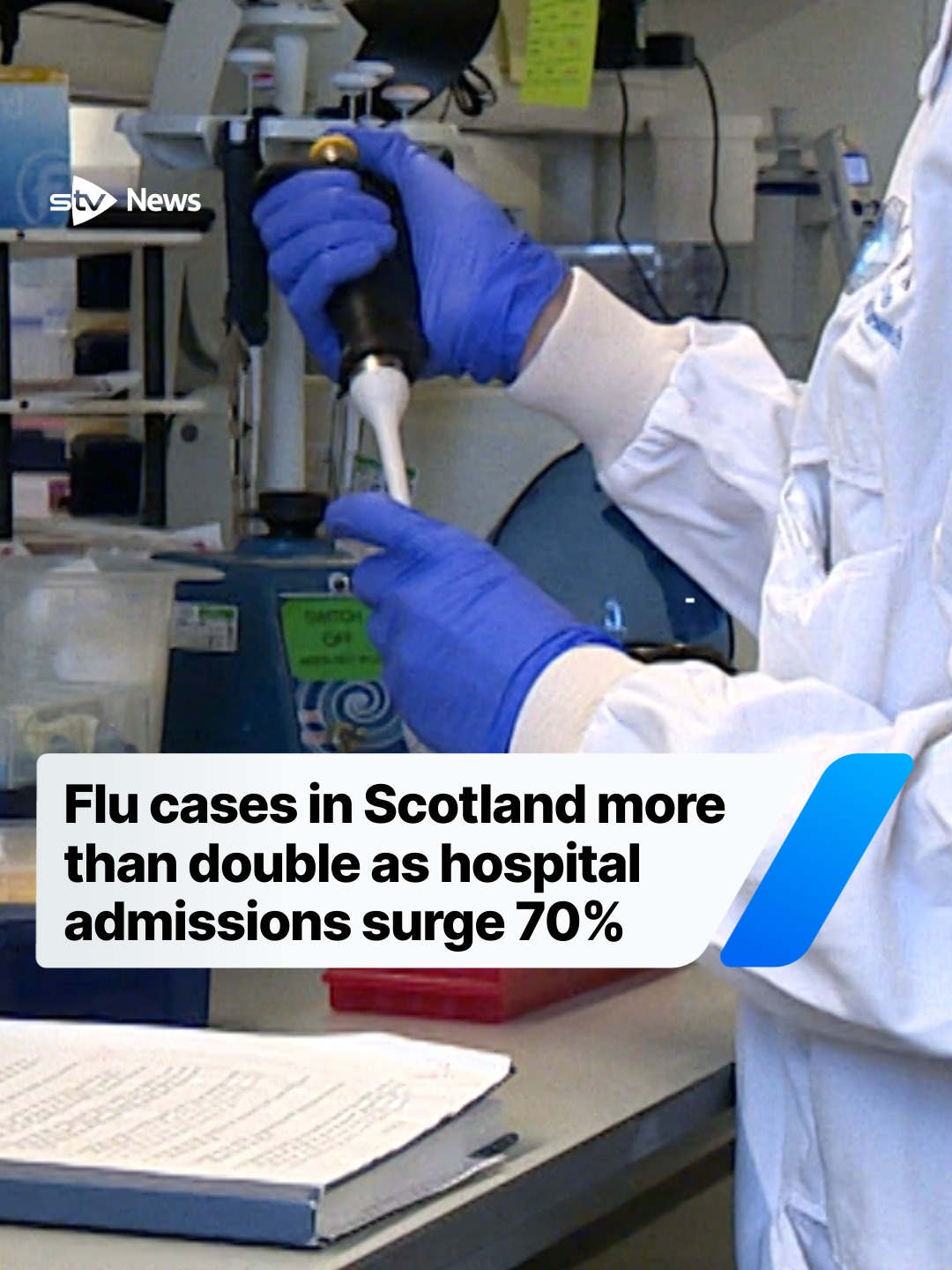 The number of flu hospital admissions in Scotland has surged by 70% in the last week as the number of confirmed cases more than doubled. Hospital admissions rose from 426 to 724 between November 24 to 30, while laboratory-confirmed flu cases rose from 845 to 1,759, Public Health Scotland (PSH) figures show. Cases have increased in all groups, but have reached a higher intensity in ages one to four and have been described as at a “very high” level in the five to 14 age groups. Those aged 65 and over make up around 40% of all hospital admissions, with those aged 75 and over representing the highest proportion. This is down to a mutation of the H3N2 strain of influenza, which is known for causing more severe illness, particularly among older adults. The number of people visiting their GP for flu-like illnesses has increased, with the number of consultations exceeding the medium threshold three weeks earlier than last season. Provisional death registrations with flu listed as an underlying cause increased from five to seven. During the same time period in previous seasons, there were two or fewer flu deaths registered. #flu #influenza #health #Scotland #news #scottishnews #stvnews