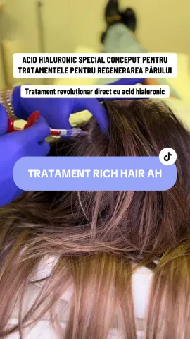 Acid Hialuronic Rich Hair #ah #acidhialuronic #hair #scalp #par 