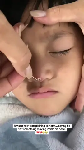 😭 #hospital #son #nose #mom #fyp 
