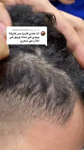 الحل النهائي لعلاج مشكلة القشرة 😱#بتاع_مشاكل_الشعر 