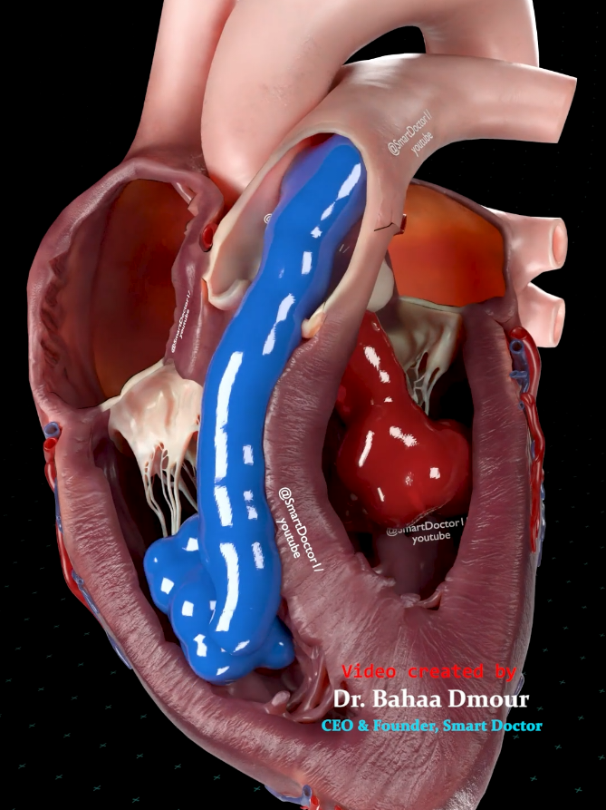 Hidden Circulation Inside the Heart 🫀 - - This 3D animation shows the blood circulation inside the human heart — the part you never get to see in real life. You can follow the blood as it moves through the right side to the lungs and then returns to the left side before being pumped out through the aorta to the rest of the body. In this model, blue blood is used to represent deoxygenated blood (low in oxygen), and red blood represents oxygenated blood (rich in oxygen). In reality, this “blue” blood is actually dark red, but the color difference here makes it much easier to understand what is going to the lungs and what is coming back from the lungs. This video is made to help viewers clearly visualize how the heart and lungs work together to keep us alive with every single beat. 🎥 Video created by Dr. Bahaa N Dmour, CEO & Founder of Smart Doctor - - #EducatorAward  #LIVEFEST2025  #anatomy  #education  #cardiology 