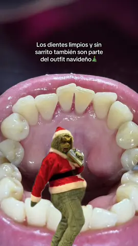 ¿Ya se realizaron su limpieza dental para esta navidad? #foryou #foryoupage❤️❤️ #dentista #vir #viral_video 