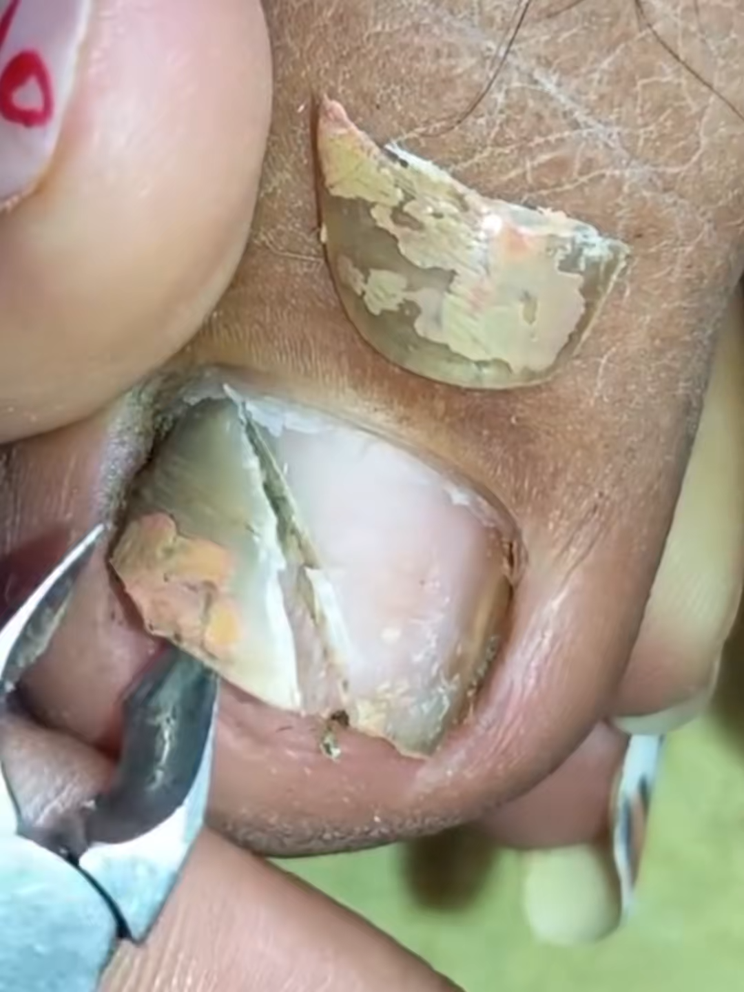 Tôi nhẹ nhàng lấy khoé móng cho mẹ, mẹ bảo già rồi da mỏng, làm nhẹ thôi. Tim tôi cũng mỏng y như thế mỗi lần thấy mẹ yếu đi một chút. #mongxinhvietnam #beautyvietnam #nailtutorial #chamsocmong #tiktokviral