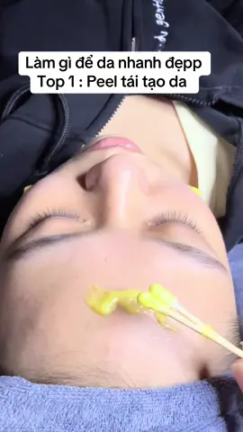 Top 1 : peel da ạ 👇🏻👇🏻 #trietlongquynhcoi #thaibinh #peelda #peeldaquynhcoi #spaquynhcoithaibinh